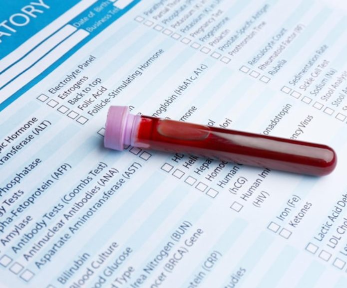 Test Result Entry & Alerts